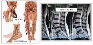 Chấm dứt đau xương khớp - Cột sống Giá bán: 160.000đ
